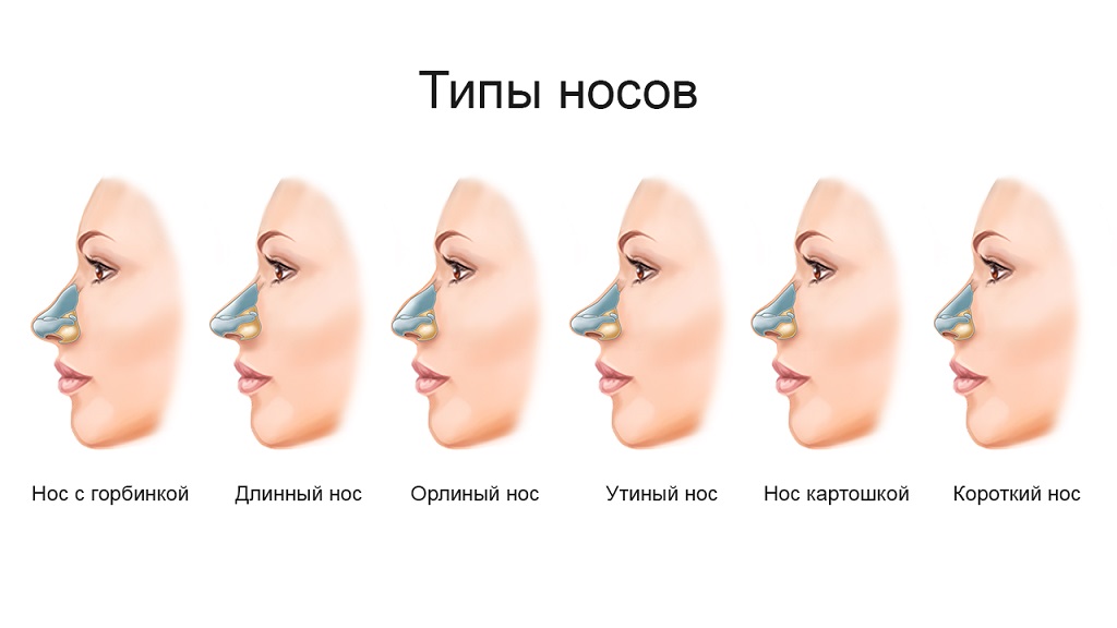 корректируемые хирургическим методом формы носа